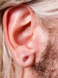 irritation signs of earring infection